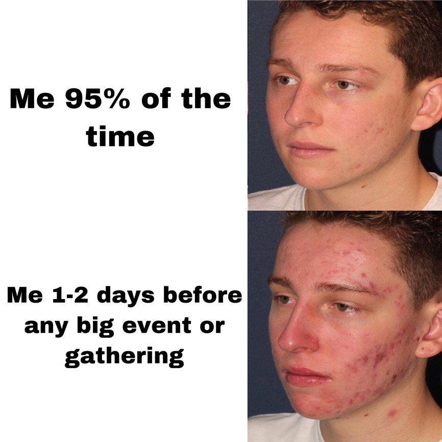 Stress meme Me 95 of time vs Me 1-2 days before any big event or gathering